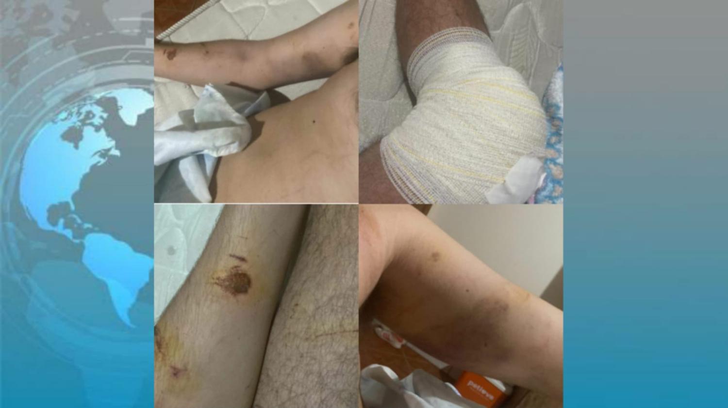 Momentos de terror, jovem é ameaçado por 05 homens encapuzados com espingardas a vítima fugiu pela mata para não morrer.
